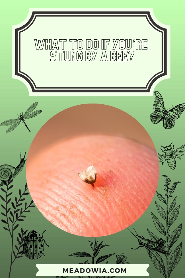 What to do if You’re Stung by a Bee pin by meadowia